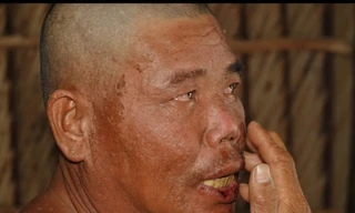 Gặp ngư dân ở Kiên Giang sống sót thần kỳ sau 4 ngày trôi dạt giữa biển