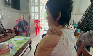 Vụ thai phụ bị chồng bạo hành dã man: Hội LHPN Kiên Giang, Hải Dương vào cuộc