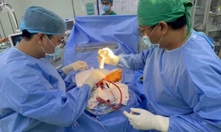 Em trai cầm kéo đuổi mèo hoang không may đâm xuyên đầu chị