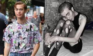 Sao truyền hình Anh gây sốc với thân hình ‘bộ xương di động’