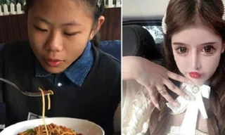 Thiếu nữ 16 tuổi phẫu thuật thẩm mỹ 100 lần trong ba năm