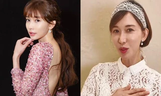 ‘Giật mình’ với gương mặt đơ cứng, khác lạ của Lâm Chí Linh