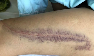 Người đàn bà bị 'phi công trẻ' đuổi chém dã man, lột đồ giữa đường vì ghen