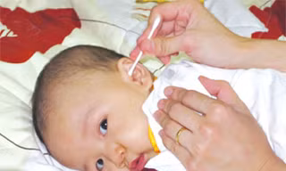 Thủng màng nhĩ là bị điếc?