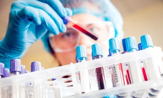 Một bệnh nhân ở tỉnh Đồng Nai điều trị bệnh tan máu bẩm sinh đã được Quỹ Bảo hiểm y tế chi trả với mức khoảng hơn 5 tỷ đồng. Ảnh minh họa: Internet