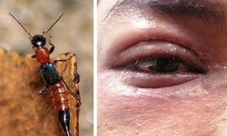 Ảnh minh hoạ: Internet