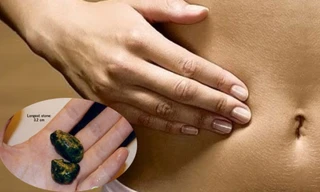 Ảnh minh hoạ: Internet