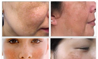 Ảnh minh hoạ: Internet