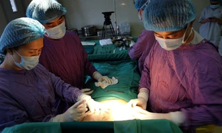 Các BS đang phẫu thuật cho bệnh nhân có vòng 1 khủng lồ