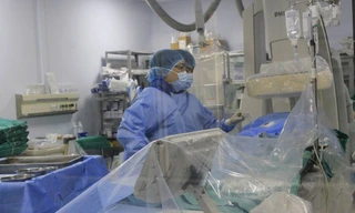 Các BS Bệnh viện E can thiệp cho bệnh nhân bị nhồi máu cơ tim cấp. Ảnh: BV cung cấp