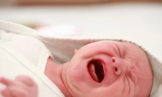 rẻ có biểu hiện đau bụng cơn, biểu hiện bằng cơn khóc thét xuất hiện đột ngột, dữ dội, trẻ ưỡn người, xoắn vặn, cơn đau... có thể đã bị lồng ruột. Ảnh minh hoạ: Internet