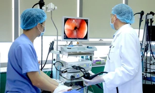 Nội soi dạ dày, sinh thiết lấy mẫu bệnh phẩm cho kết quả tương đối tốt để phát hiện HP. Ảnh minh hoạ: Internet