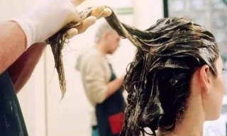 Thiếu nữ 17 tuổi bị bỏng nặng vì uốn tóc làm đẹp