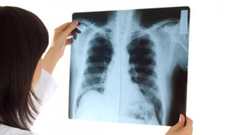 Ảnh minh hoạ: Internet