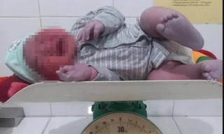 Sản phụ 28 tuổi sinh bé trai nặng hơn 6 kg 