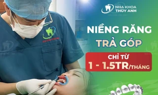 Niềng răng trả góp chất lượng cao tại nha khoa Thùy Anh 