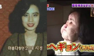 'Choáng váng' trước diện mạo kinh hãi của nữ ca sĩ Hàn từng tự bơm dầu ăn vào mặt