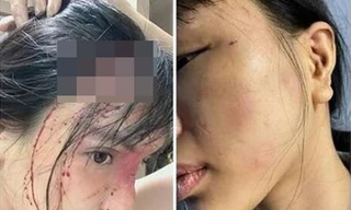 Hình ảnh thương tích của nạn nhân.