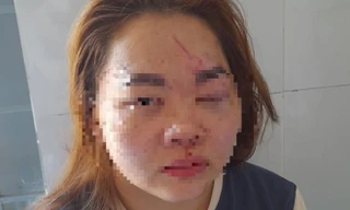 Tin mới vụ thầy giáo ở Đắk Lắk đánh vợ nhập viện cấp cứu