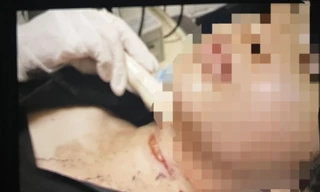 Xử phạt cô gái hoang báo bị cứa cổ cướp của