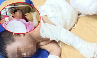Bắt nhóm đối tượng phóng hỏa khiến 2 bé trai bỏng nặng