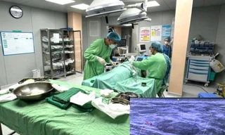 Bình Dương lần đầu sinh thiết chữa ung thư không cần phẫu thuật