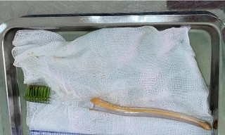 Bé trai 13 tuổi suýt chết vì nuốt bàn chải đánh răng vào bụng