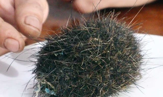 Phát hiện vật thể lạ nghi 'trứng vàng' quý hiếm trong dạ dày lợn ở Bình Phước