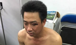 Đã bắt được tên trộm chó lái ô tô tông vào tổ tuần tra