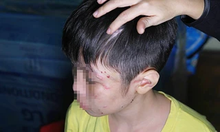 Tin nóng 24H: Cuộc sống đọa đầy của bé trai nghi bị bố bạo hành