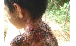 Cuộc sống cơ cực của những người bị 'quỷ ám'