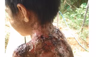 Cuộc sống cơ cực của những người bị 'quỷ ám'