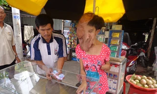 Cô gái hơn 2 thập kỷ sống với mũi, tai, miệng... chảy dài xuống ngực