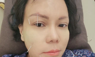 Việt Hương bị méo mặt