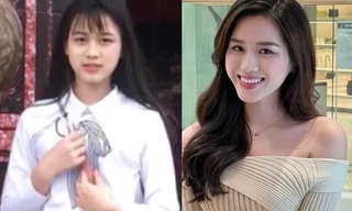 Bức ảnh khiến Hoa hậu Đỗ Thị Hà vướng nghi vấn phẫu thuật thẩm mỹ