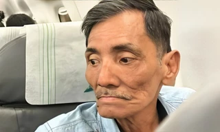 Thương Tín nguy cơ tàn tật vĩnh viễn