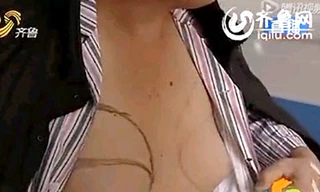 Ngực to như phụ nữ vì uống thuốc chữa vô sinh