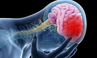 'Sát thủ thầm lặng' liên quan chứng mất trí nhớ và đột quỵ