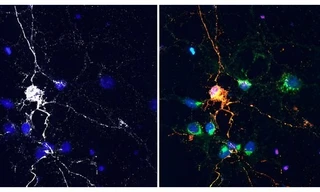 Mỹ: Nghiên cứu thuốc trị ung thư đạt được điều bất ngờ