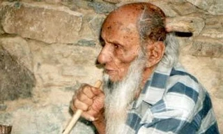 Cụ già mọc sừng sau những giấc mơ