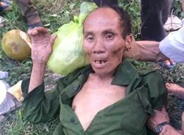 Cứu cụ ông ngất xỉu bên đường vì đói