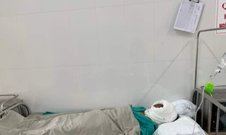 Rò rỉ bình gas gây cháy, 4 người nguy kịch