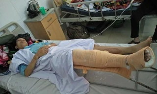 Một nạn nhân điều trị tại bệnh viện