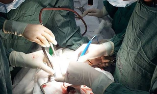 Người đàn ông bị gỗ đập vỡ tim