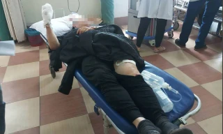 Tài xế xe ôm chém đứt lìa tay chủ quán ăn