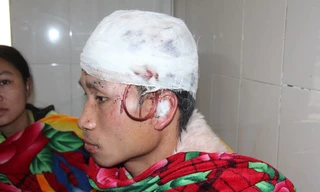 Gấu rừng tấn công người đàn ông “giả chết”