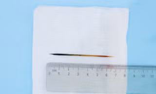 Hi hữu: Người đàn ông ngủ quên, nuốt tăm 7cm vào bụng