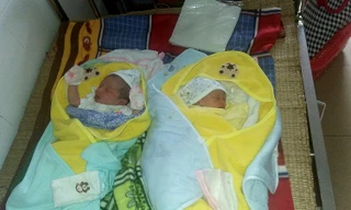 Bệnh viện biên giới mổ thành công ca sinh đôi nguyên bọc ối