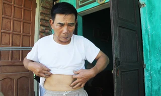 Khôi phục, truy lĩnh chế độ cho 30 thương binh thật ở Nghệ An