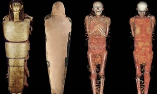 Xác ướp bí ẩn 2.000 năm tuổi được cho là xác ướp của một "bác sĩ nhãn khoa" thời cổ đại.